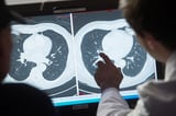 Doctors hail cancer injection that can destroy entire tumors