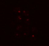 Common yeast can survive Martian conditions