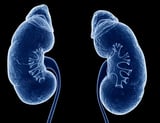 Novel CAR T treatment makes previously impossible kidney transplants possible