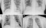 Medical X-rays taken in space for the first time