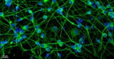 $13 million CIRM award to fund research on the role of RNA pollution in neurodegenerative diseases