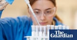 People in the US: have you been affected by Trump’s cuts to scientific research?