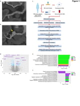 Scientists discover potential cause of an enigmatic vascular disease primarily impacting women