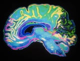 Mouse study reveals memories survive massive loss of brain synapses