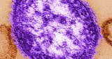 Measles May Be Spreading Undetected in Grand Junction Area After Positive Case in Unvaccinated Adult -