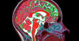 Simple brain scan reveals how fast you're ageing and 'predicts dementia'