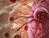 AI model predicts future lung cancer risk from a single low-dose chest CT scan