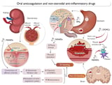 Risk of internal bleeding doubles when people on anticoagulants take NSAID painkiller, study finds