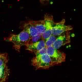 Breast Cancer and Autism: Visualisation of the oxytocin receptor enables new theranostic approaches | Newswise
