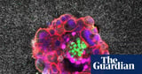 Scientists capture first footage of human embryo implanting in a uterus