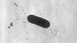 What to know about food poisoning illnesses caused by listeria | AP News