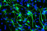 Prof Veron Ramsuran: Unlocking the Genetic Secrets to a Longer Life