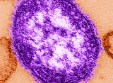 2 more measles-associated deaths reported in Pennsylvania as statewide outbreak grows to nearly 700 cases