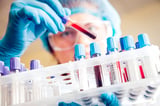 Drug-screening biz DISA took a year to disclose security breach affecting millions