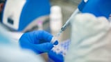 Public health officials in Pa. won’t say how they’d handle a $500M cut sought by Trump admin