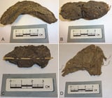 Ancient DNA provides clues to intestinal parasites that plagued early Mexico