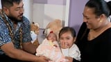 Youngest premmie baby to survive in Aus