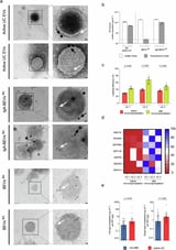 New cause of chronic inflammation in ulcerative colitis discovered