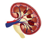 Preclinical studies test novel gene therapy for treating IgA nephropathy