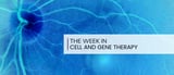 Cell therapy weekly: in vivo CAR-T therapy for autoimmune disorders