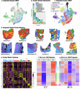 Scientists develop a foundational map of tumor cells for personalized brain cancer treatments