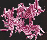 Study identifies potential novel drug to treat tuberculosis