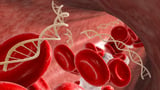 Smart nanoparticles launch genetic attack on lung cancer and cystic fibrosis