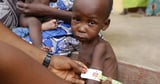 Climate change and conflict increase malnutrition rates in Nigeria