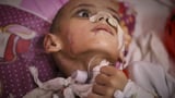Gaza: A boy with a brain injury fights for his life | AP News