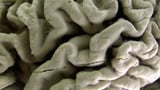 Study shows a blood test can help identify healthy people at high risk for Alzheimer's disease
