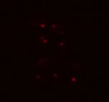 Yeast survives Martian conditions