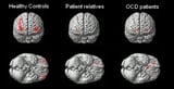 Scientists find genes linked to OCD, raising the prospect of new treatments