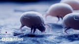 NICE backs 'life-changing' tablet for dust mite allergies