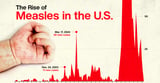 Visualized: America’s Surge in Measles Cases in 2025