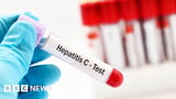 Hepatitis C test: GPs to help NHS find more infected blood victims