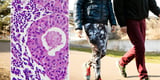 Cancer: Scientists uncover optimal daily step count to slash your risk of disease by up to 26%