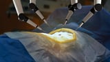 NICE Approves 11 Robotic Surgery Systems for NHS Use