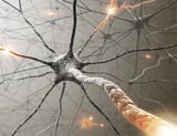 AI tool accurately distinguishes between glioblastoma and primary central nervous system lymphoma
