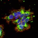 From breast cancer to autism, visualization of oxytocin receptor enables new imaging approaches