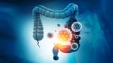 Goodbye colonoscopy? Simple stool test detects 90% of colorectal cancers