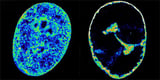 Herpes Can Reshape the Genome in Human Cells