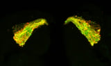 Promising Alzheimer's drug candidate prevents buildup of tau proteins in lab and fruit fly studies