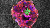 Watch a human embryo implant itself — with brute force