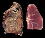 Airway Cells, Not Immune, Key to Silicosis Insight