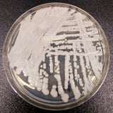Drug-resistant fungus is ‘urgent threat’ according to CDC, and infections are spreading