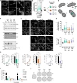 Mitochondrial dynamics provide clues for halting the metastatic progression of breast cancer