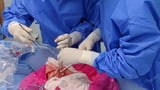 Gene-edited pig lung transplanted into a brain-dead patient for first time