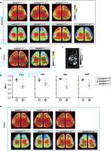 Human-specific DNA enhancer linked to brain development and neuron proliferation