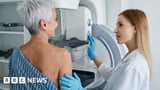 Call for NHS to give women with dense breasts extra cancer scans