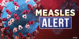 3 measles cases confirmed in Delta County